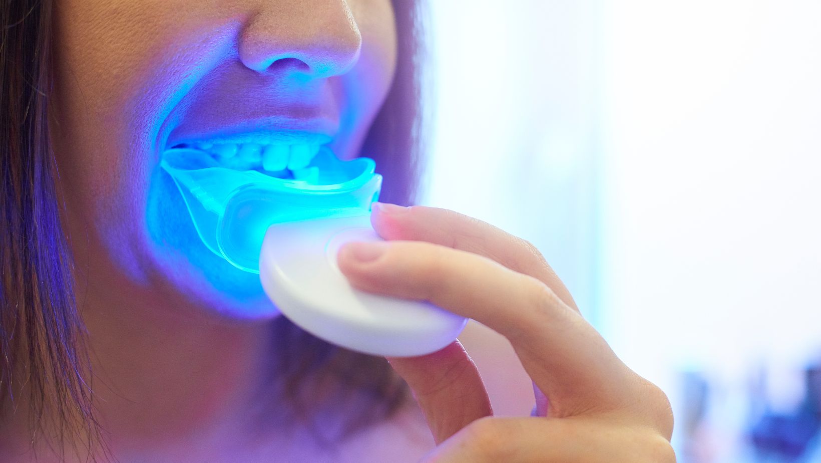 Why Are Custom Teeth Whitening Products Worth the Investment?