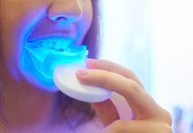 Why Are Custom Teeth Whitening Products Worth the Investment?